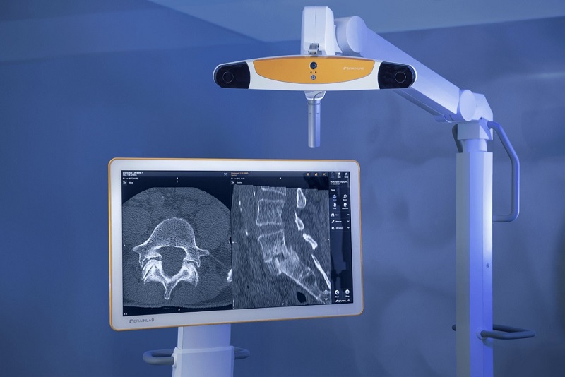 BrainLab Navigation System for Spinal Surgery