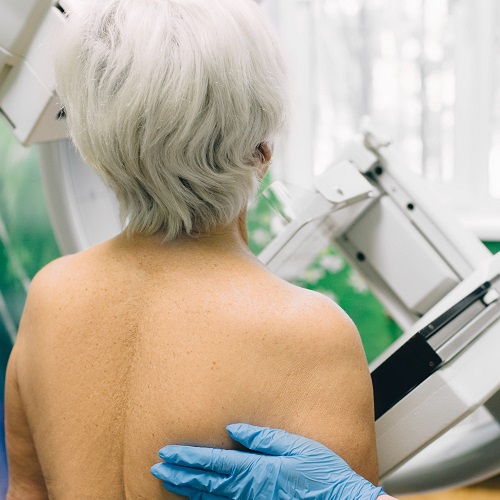 Mammogram: Preparing for a Breast Cancer Screening